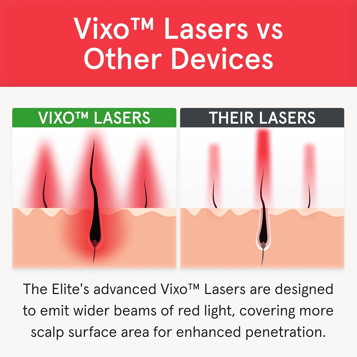 iRestore Elite - Laser Red Light Therapy for Hair Growth System - FDA Cleared Hair Loss, Hair Thinning & Alopecia Treatment for Men & Women - Laser Cap for Hair Regrowth Stimulates Denser Fuller Hair - Image 8