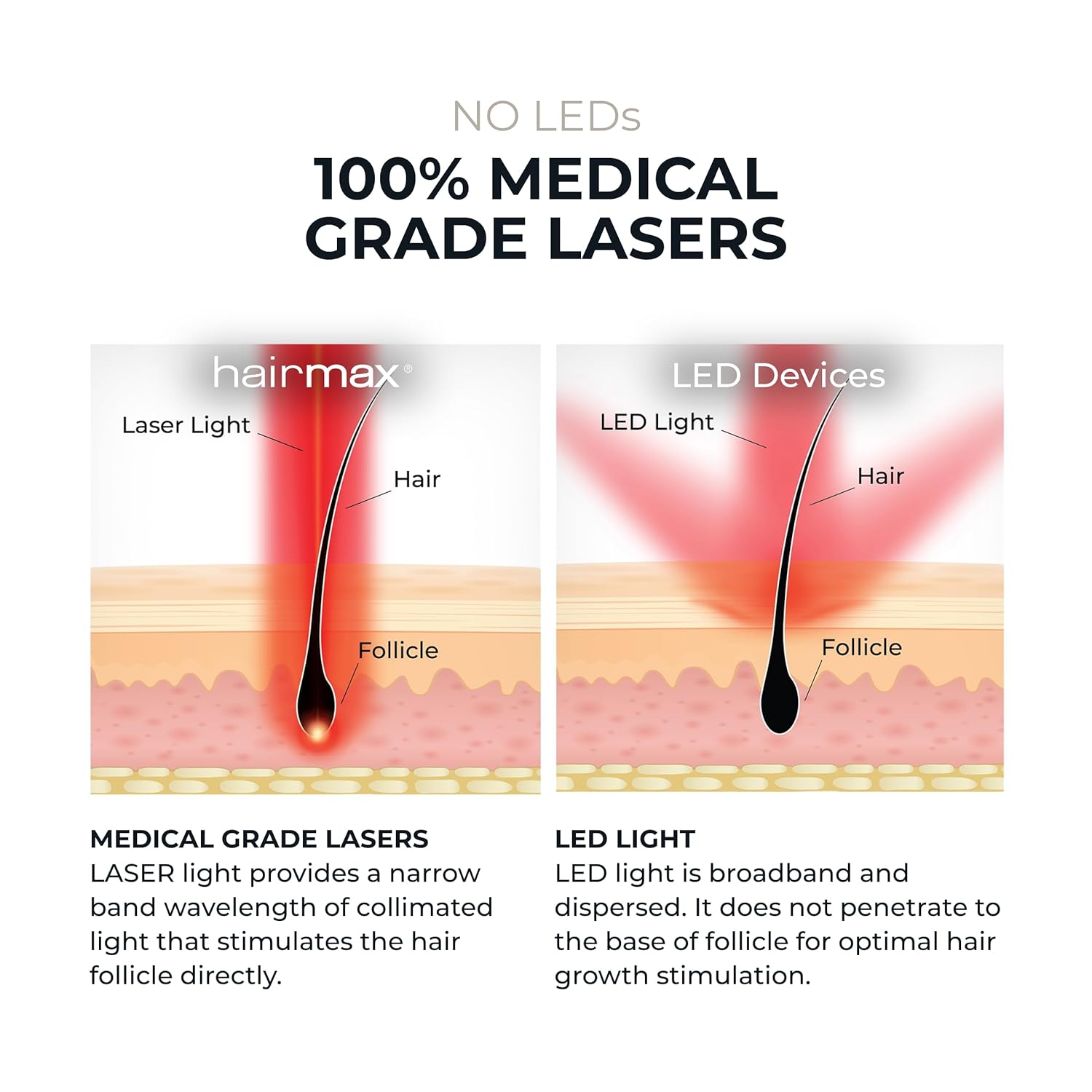 HairMax Laser Band 41 - (FDA Cleared) Hair Growth Device - Restores Natural Hair Cycle with Red Light Therapy - Image 9
