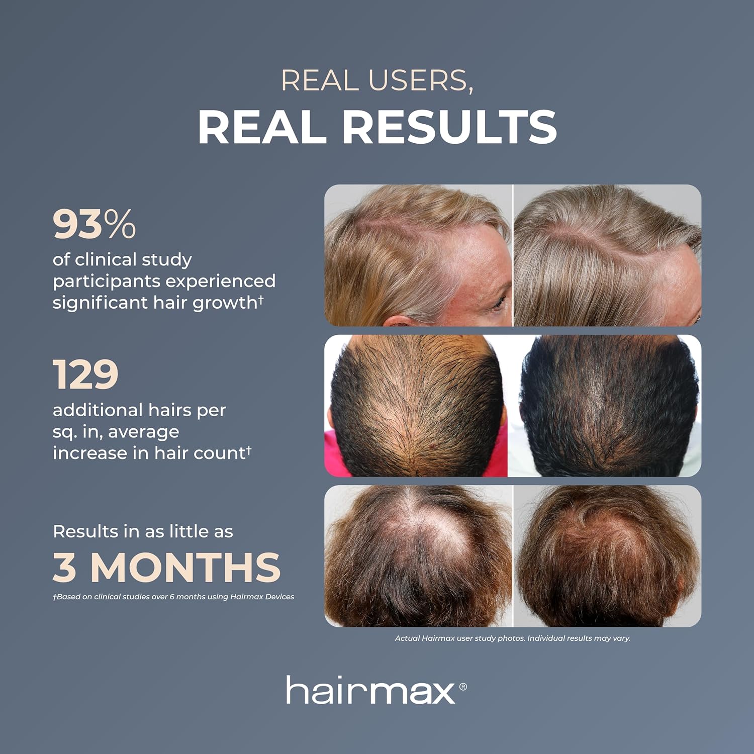 HairMax Laser Band 41 - (FDA Cleared) Hair Growth Device - Restores Natural Hair Cycle with Red Light Therapy - Image 6